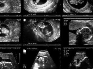 做试管婴儿的妈妈需要注意哪些问题？试管婴儿妈妈注意事项