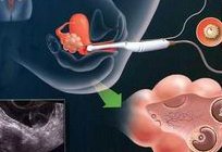 不孕不育在樟树市做试管的费用有多少？一文告诉你做三代试管建档的流程有哪些